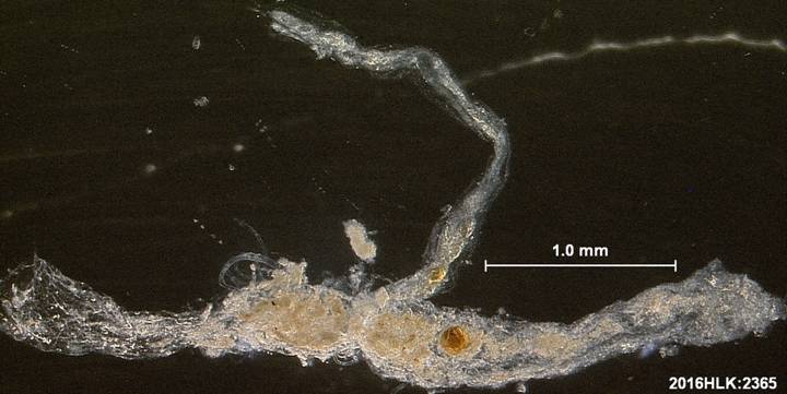 C longicosta rectum