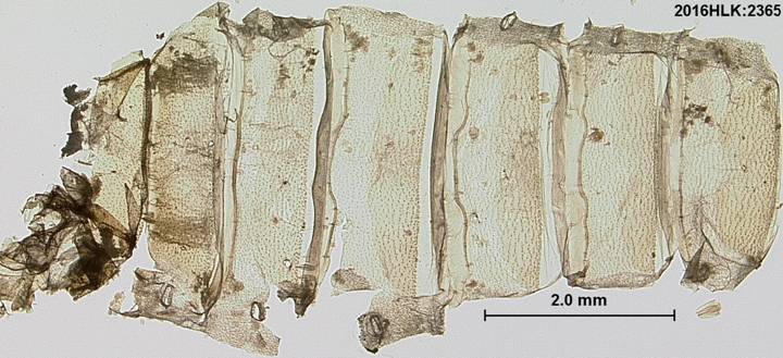 C longicosta abdomen dorsum