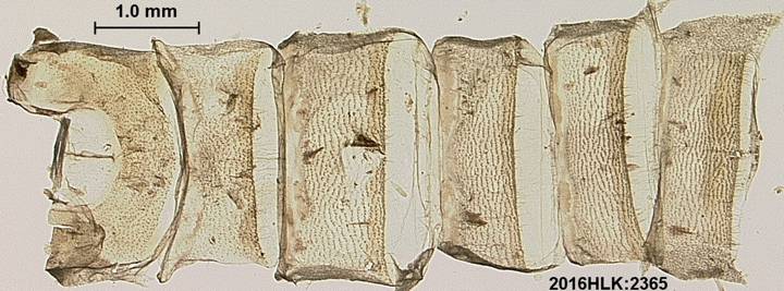C longicosta abdomen venter
