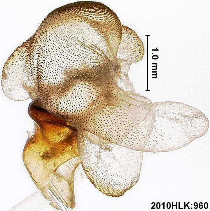 C varians 960 vesica lateral down ob