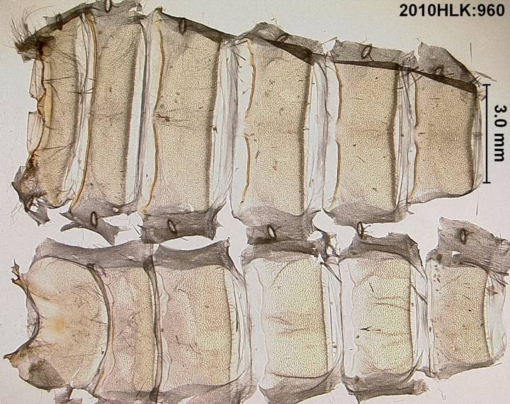 C varians 960 abdomen