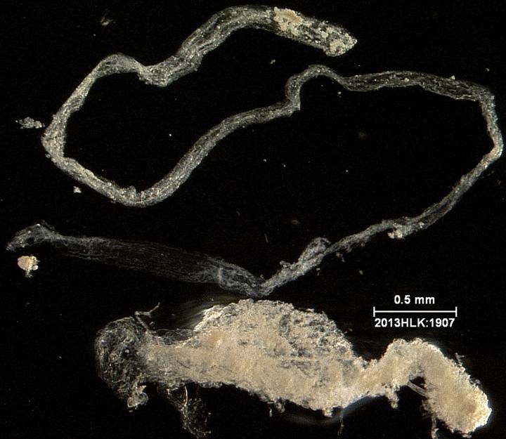 Drasteria 1907 rectum