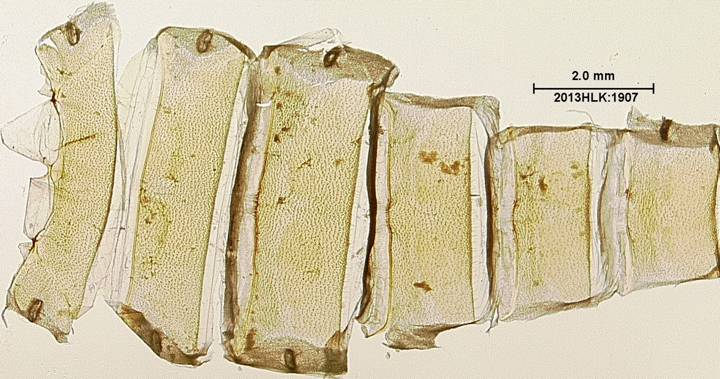 Drasteria 1907 abdomen dorsum