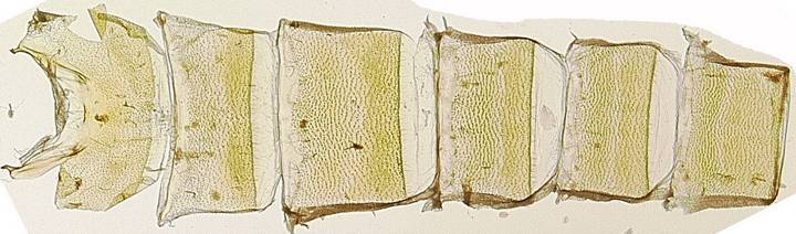 Drasteria 1907 abdomen venter