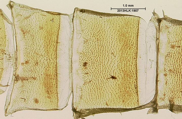 Drasteria 1907 abdomen venter zoom