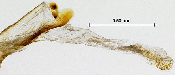 Bleptina minimalis 526 phallus eversion 3 LA - Copy