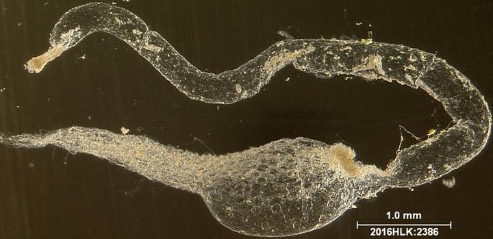 C janais 2386 rectum