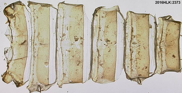 Z strig 2373 abdomen dorsum