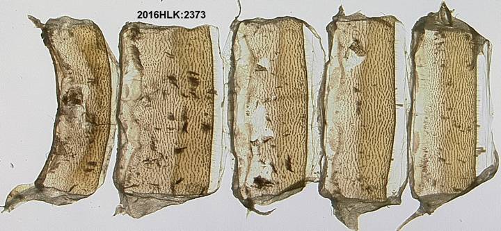 Z strig 2373 abdomen venter